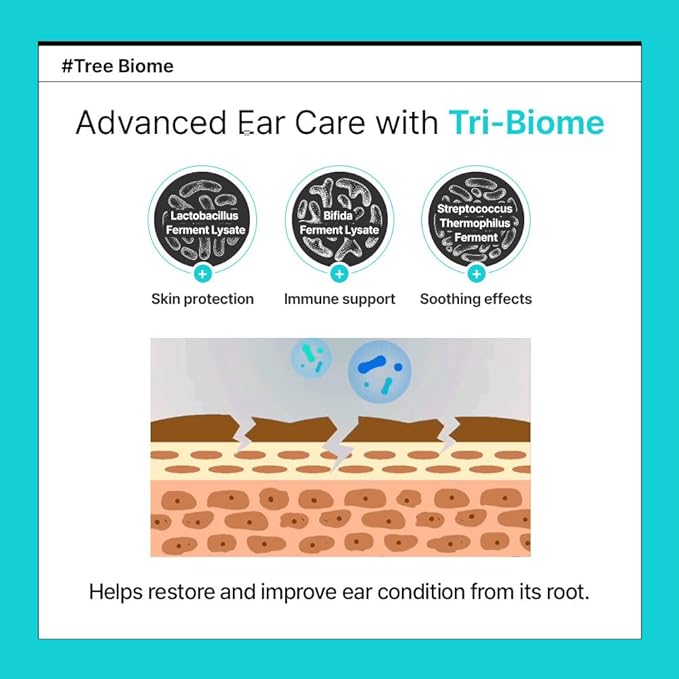 PetO’CERA EEF Ear Cleaner for Dogs & Cats, Vet Approved, Otic Enzymatic Infection Treatment, Gently Removes Debris, Odor, Soothes Itching, Hypoallergenic, Alcohol-Free, No Sting 4 fl oz