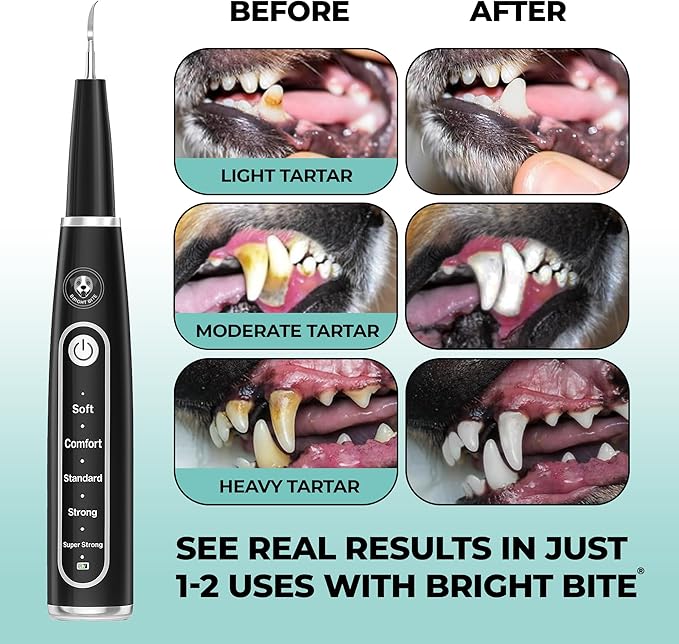 BRIGHT BITE™ | Ultrasonic Plaque Remover for Teeth | Dog Toothbrush; Cat Toothbrush | Quiet Tartar Remover | Dog Accessories | Teeth Cleaning Tools| Doggie Dental Scaler | Dental Tools | USB-C